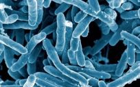 Micrografía electrónica de Mycobacterium tuberculosis, bacteria causante de la enfermedad (Foto. NIH)