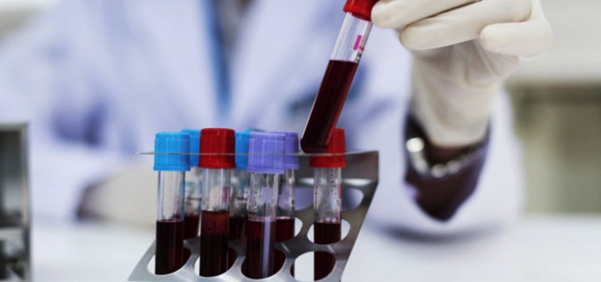 Científico analizando muestras de sangre (Foto. Freepik)