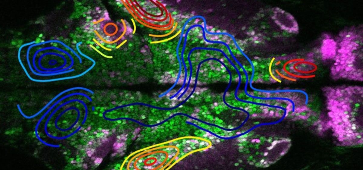 El inicio de las convulsiones ocurre en regiones caracterizadas por células excitatorias (morado) antes de propagarse a regiones dominadas por neuronas inhibidoras (verde) (Foto. EP)