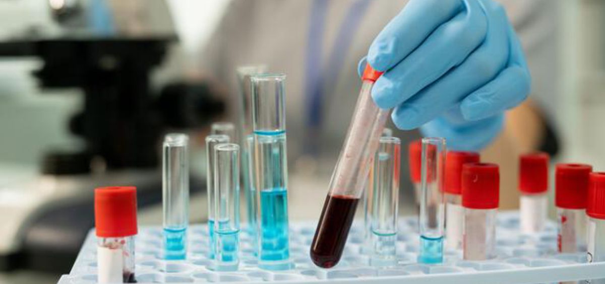 Científico analizando muestras de sangre en un laboratorio (Foto. Freepik)