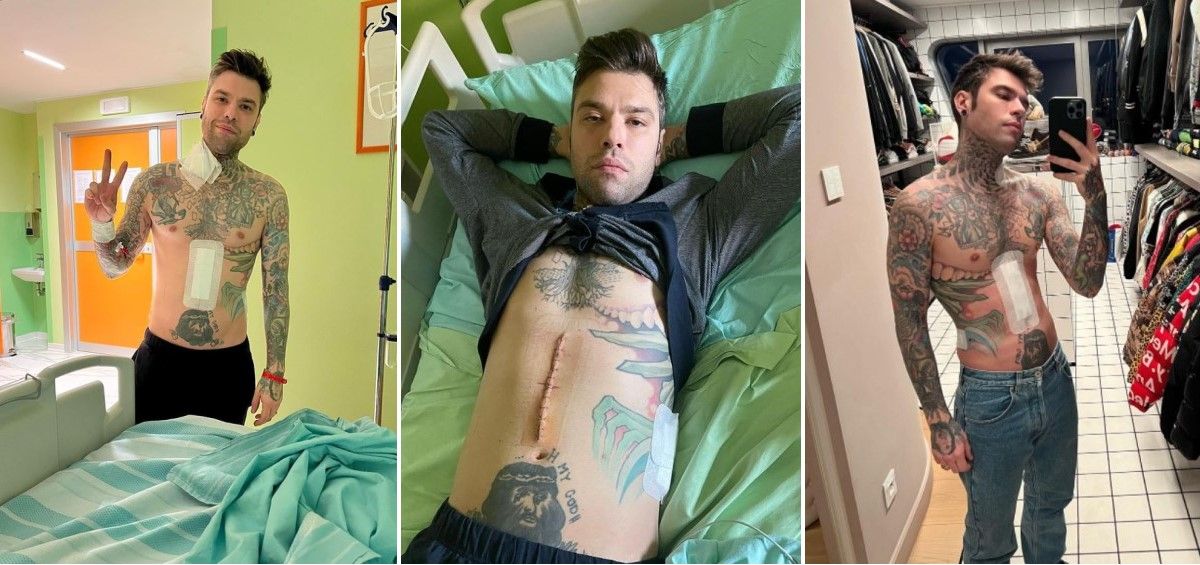 El rapero Fedez, marido de Chiara Ferragni, tras la operación que le ha extirpado un raro tumor. (Fotomontaje. ConSalud.es)