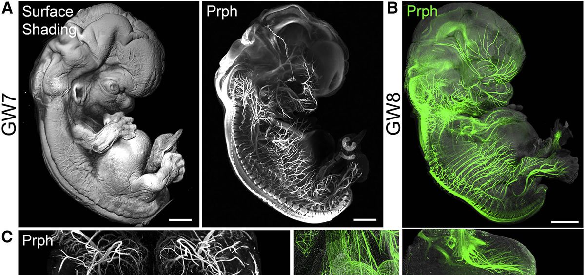 Imágenes 3D deel sistema nervioso de un embrión (Foto. Investigación en la revista 'Cell')