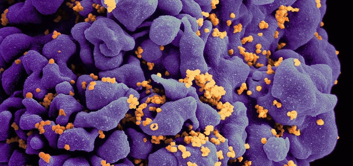 Micrografía electrónica de barrido de una célula T H9 infectada por el VIH (Foto: NIAID)