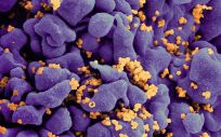 Micrografía electrónica de barrido de una célula T H9 infectada por el VIH (Foto: NIAID)