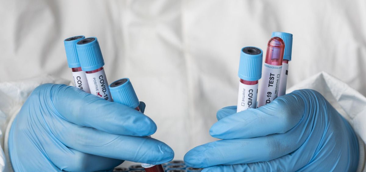 Científico sosteniendo muestras de sangre de pacientes infectados por SARS-CoV-2 (Foto. Freepik)