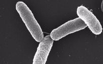 Imagen al microscopio de Salmonella enterica serovar Typhimurium. (Foto. Brinkmann, Planck Institute Infection Biology. EP)