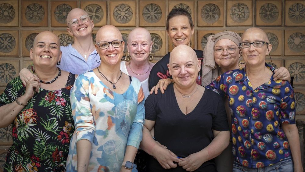 Varias obras visibilizan la alopecia femenina