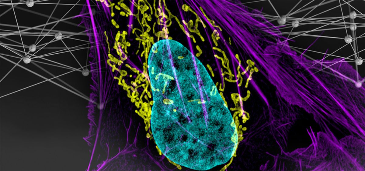 Célula cancerígena analizada por los investigadores para conocer el genoma (Foto. MIT)