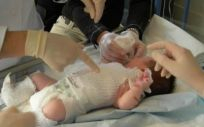 Bebé con piel de mariposa o epidermólisis bullosa. (Foto. Debra)
