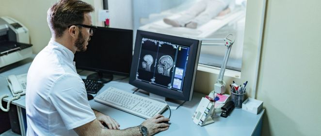 Un radiólogo mirando las imágenes de un cerebro (Foto. Freepik)