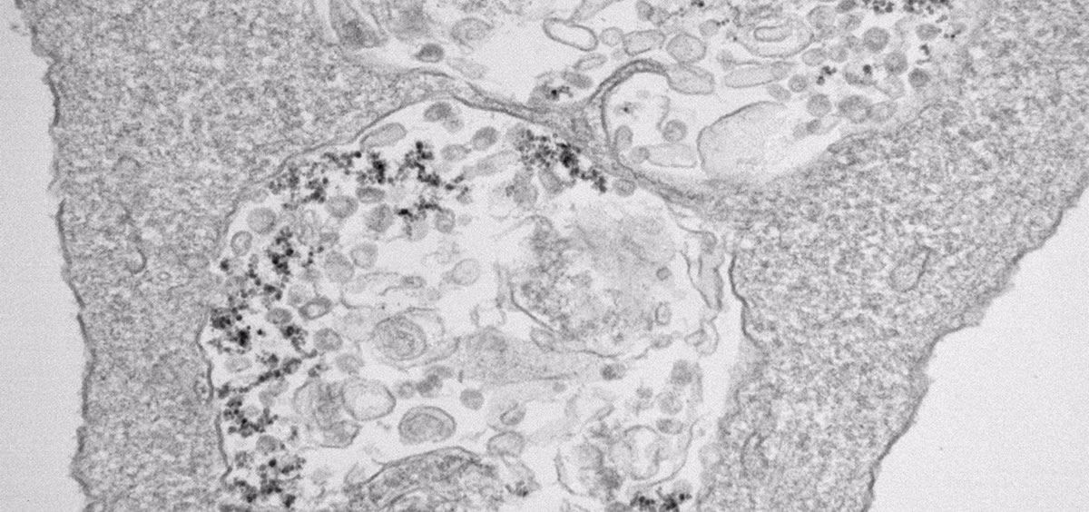 Imagen de microscopía de transmisión electrónica de células infectadas con SARS CoV 2 y tratadas con nanopartículas de óxido de hierro (Foto. CNB CSIC)