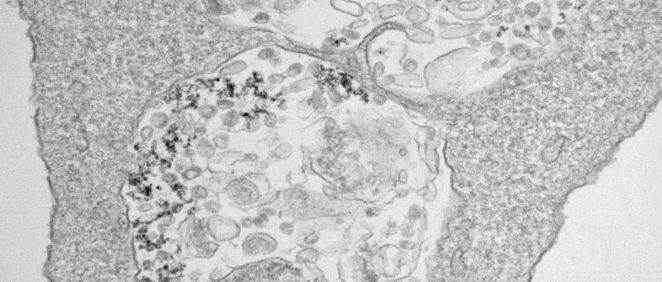 Imagen de microscopía de transmisión electrónica de células infectadas con SARS CoV 2 y tratadas con nanopartículas de óxido de hierro (Foto. CNB CSIC)