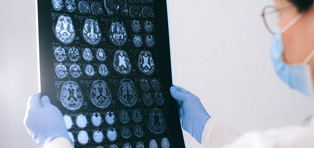 Doctora examinando un escáner cerebral (Foto. Pexels)