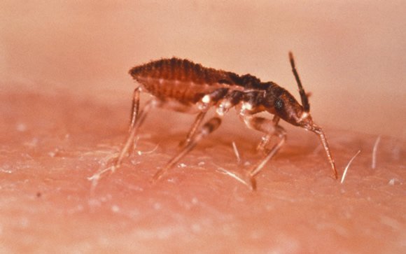 Prueba diagnóstica gratuita de la enfermedad de Chagas en Madrid