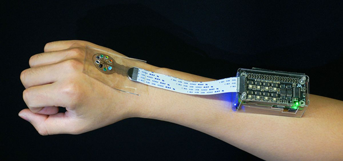 Sensor ayuda a prevenir brotes de lupus (Foto. Medgadget)  