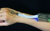 Sensor ayuda a prevenir brotes de lupus (Foto. Medgadget)  