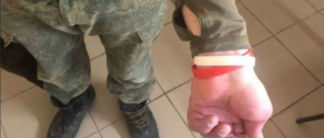 Uno de los soldados reclutados por Putin muestra el brazalete que le identifica como infectado por VIH. (Foto. Visegrad 24)