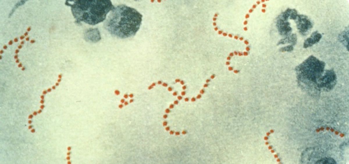 Bacteria 'streptococcus pyogenes' (Foto: PUBLIC HEALTH IMAGE LIBRARY)