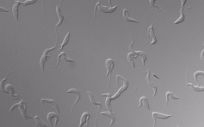 Células de ‘Trypanosoma brucei’ en cultivo observadas al microscopio. (Foto. IPBLN CSIC)