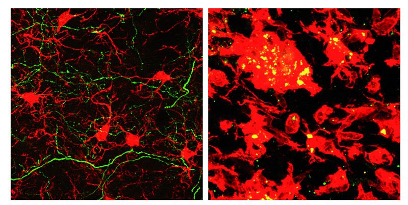 Células de la glía en dos regiones distintas del cerebro (Foto. Cima Universidad de Navarra)