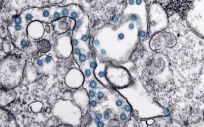 Partículas del virus SARS-CoV-2, coloreadas en azul, en una imagen de microscopio de electrones. (Foto: CDC)
