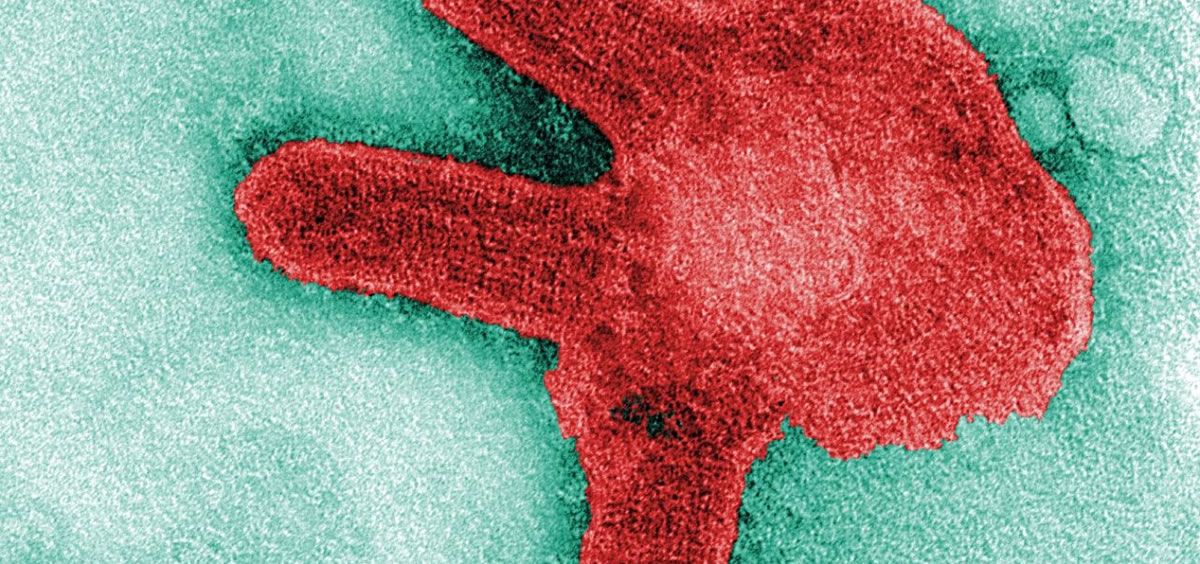 Imagen al microscopio del virus de Marburgo (Foto. F. A. Murphy/CDC)