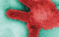 Imagen al microscopio del virus de Marburgo (Foto. F. A. Murphy/CDC)