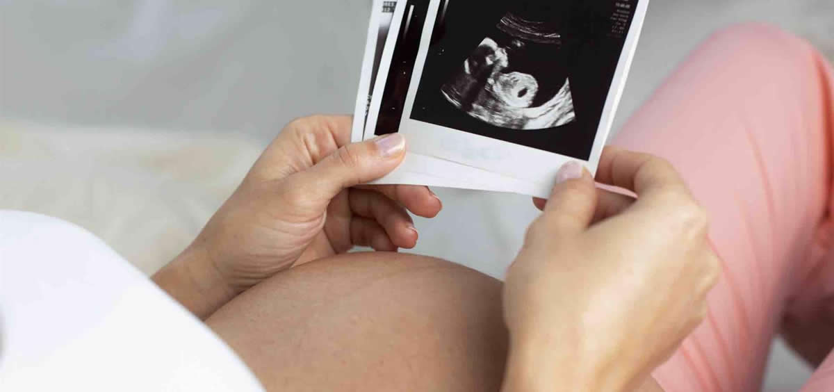  Embarazo en mujeres trasplantadas (Foto: Clínica Margen/EuropaPress)
