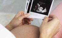  Embarazo en mujeres trasplantadas (Foto: Clínica Margen/EuropaPress)