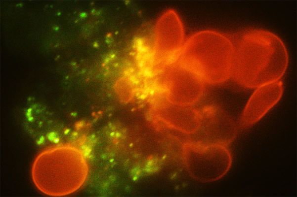 Imagen de glóbulos rojos falciformes mientras son capturados y consumidos por un macrófago tomadas por el chip (Foto. MIT Investigadores) 