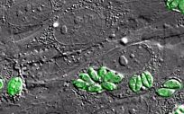 Imagen intracelular al microscopio del parásito Toxoplasma gondii, causante de la toxoplasmosis, dentro de fibroblastos humanos (Foto: ISCIII/EuropaPress)
