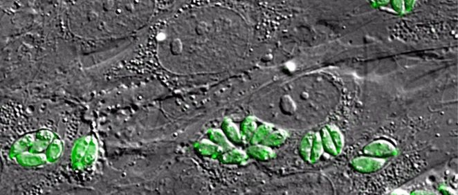 Imagen intracelular al microscopio del parásito Toxoplasma gondii, causante de la toxoplasmosis, dentro de fibroblastos humanos (Foto: ISCIII/EuropaPress)