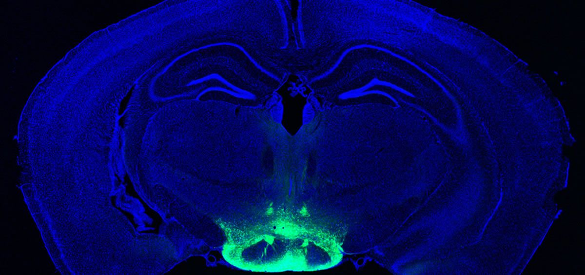 Cerebro con la zona del hipotálamo coloreada, lugar donde se acumula más placas amiloide en alzhéimer (Foto. Cortesía de los investigadores)