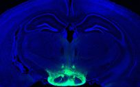 Cerebro con la zona del hipotálamo coloreada, lugar donde se acumula más placas amiloide en alzhéimer (Foto. Cortesía de los investigadores)