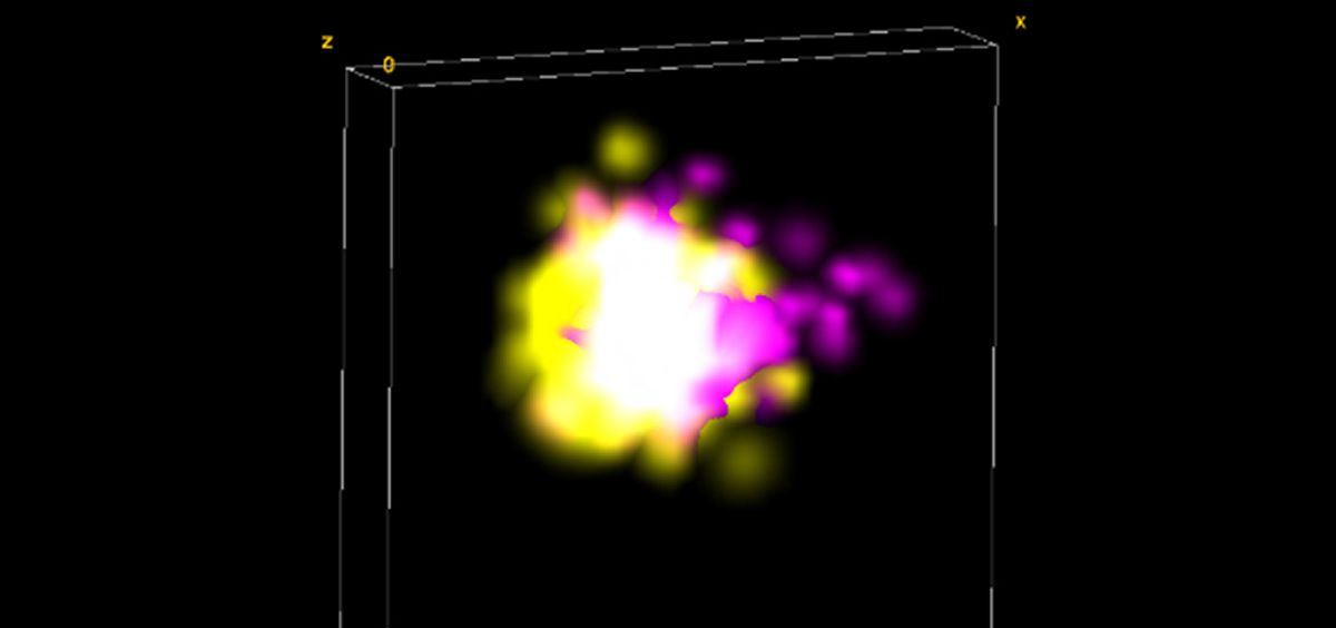 Reconstrucción en 3D de imágenes de microscopia donde se ve la proteína Tau (en amarillo) donde hay pre-sinapsis (en magenta) (Foto: IQAC/CSIC)