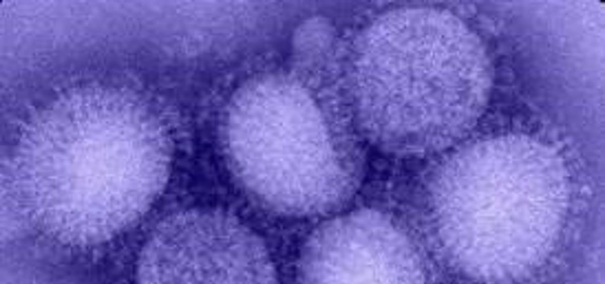  Virus de la gripe (Foto: Europapress)