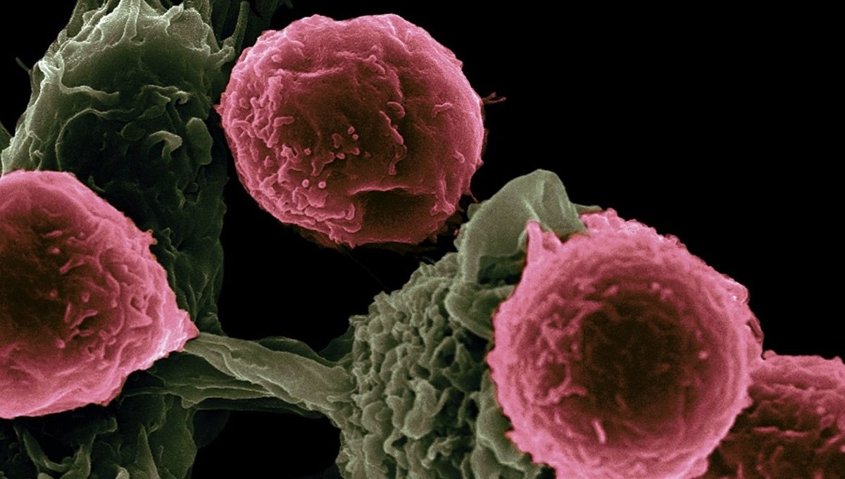 Superficie de una célula cancerosa (Foto: National Cancer Institute / CSIC)