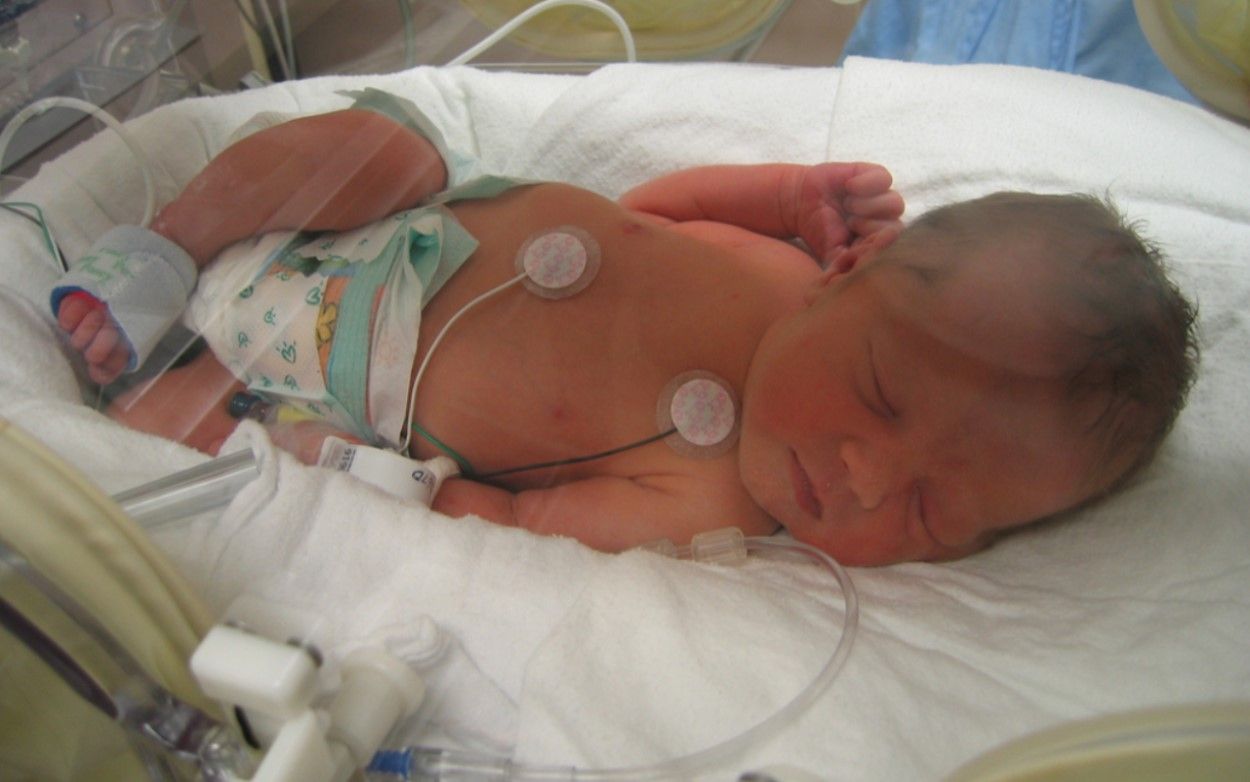 La muerte súbita infantil, vinculada a los cambios en la química cerebral del bebé