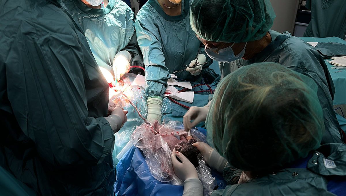 El equipo del Sant Pau realiza una reanimación con cordón umbilical a Sauk (Foto. Hospital Sant Pau)