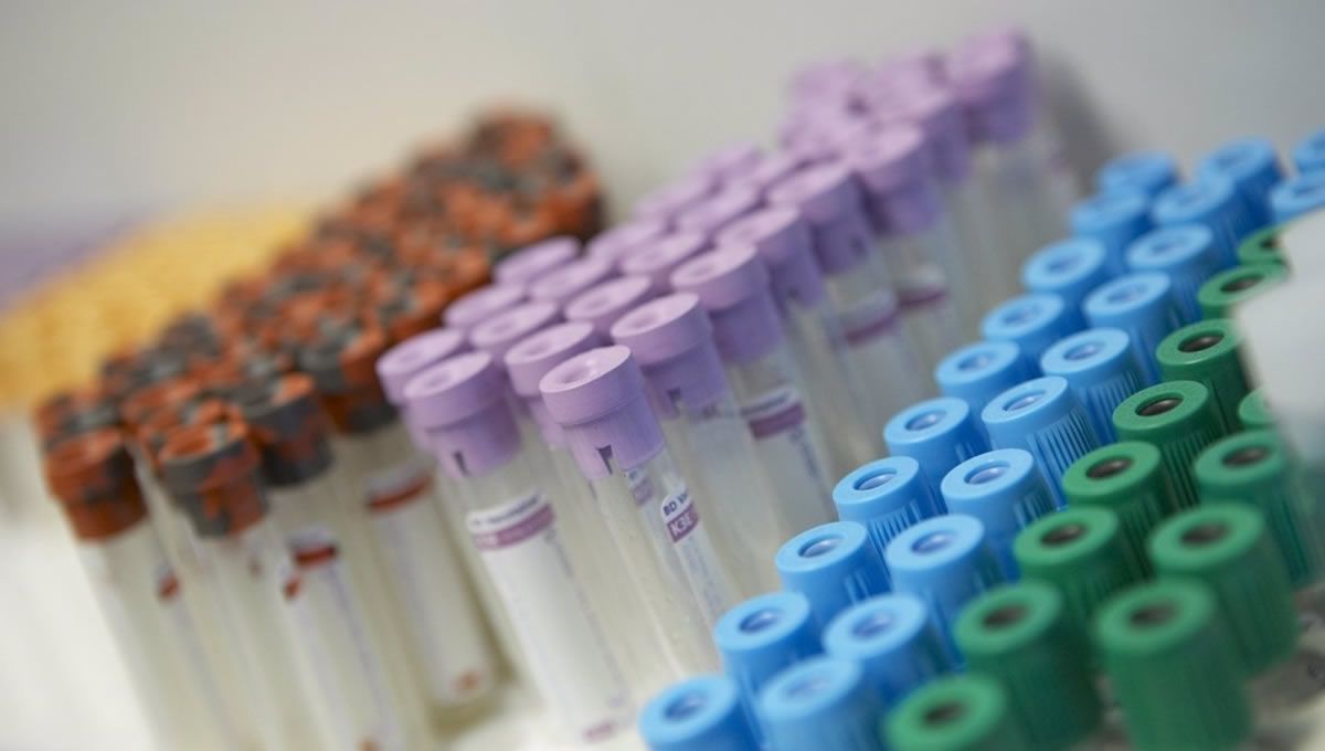 Imagen de recurso de tubos para pruebas analíticas de sangre (Foto: Europa Press)