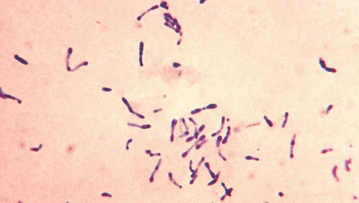 Imagen al miscroscopio de 'Corynebacterium diphtheriae', una de las bacterias causantes de la difteria (Foto: CDC Estadounidense/EuropaPress)