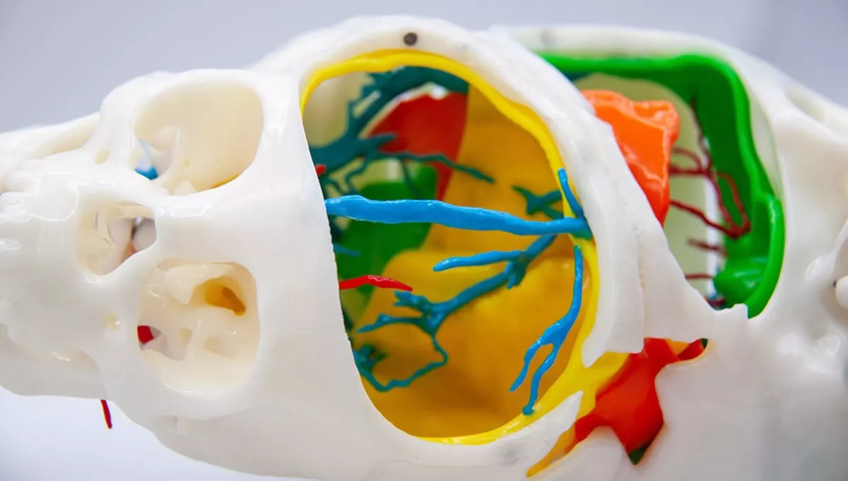 Modelo 3D cirugía cráneo gemelas (Foto: Cella/EuropaPress)