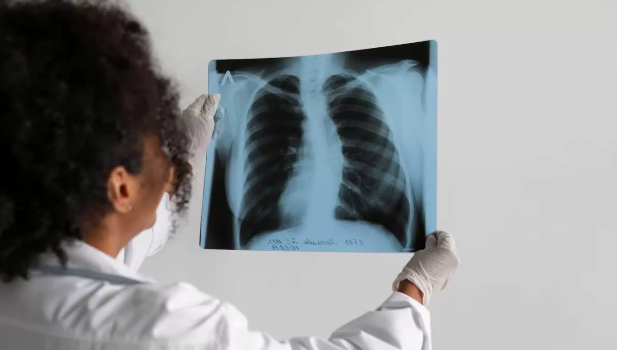 Medico revisando una radiografia de pulmón. (Fuente: Freepik)