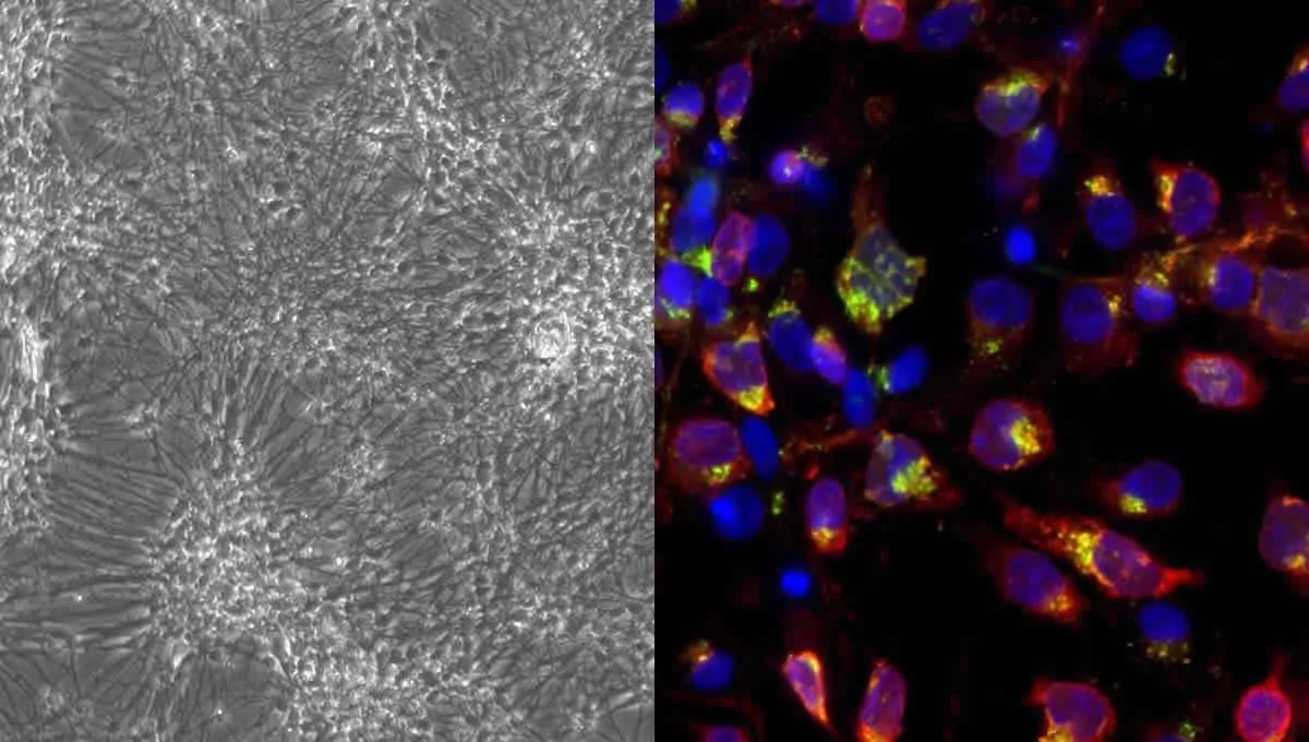 A la izquierda, una fotografía tomada con el microscopio de contraste de fases de un cultivo diferenciado de células ReN. A la derecha, una imagen de inmunofluorescencia de un cultivo de células ReN diferenciado e infectado por HSV-1.  (Foto: UAM)