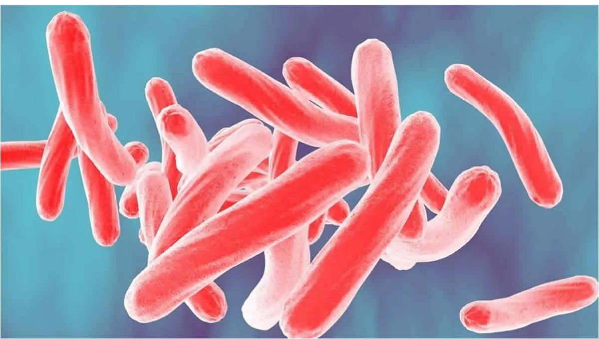 Nueva cepa multirresistente de tuberculosis (Foto: Universidad de Zúrich)