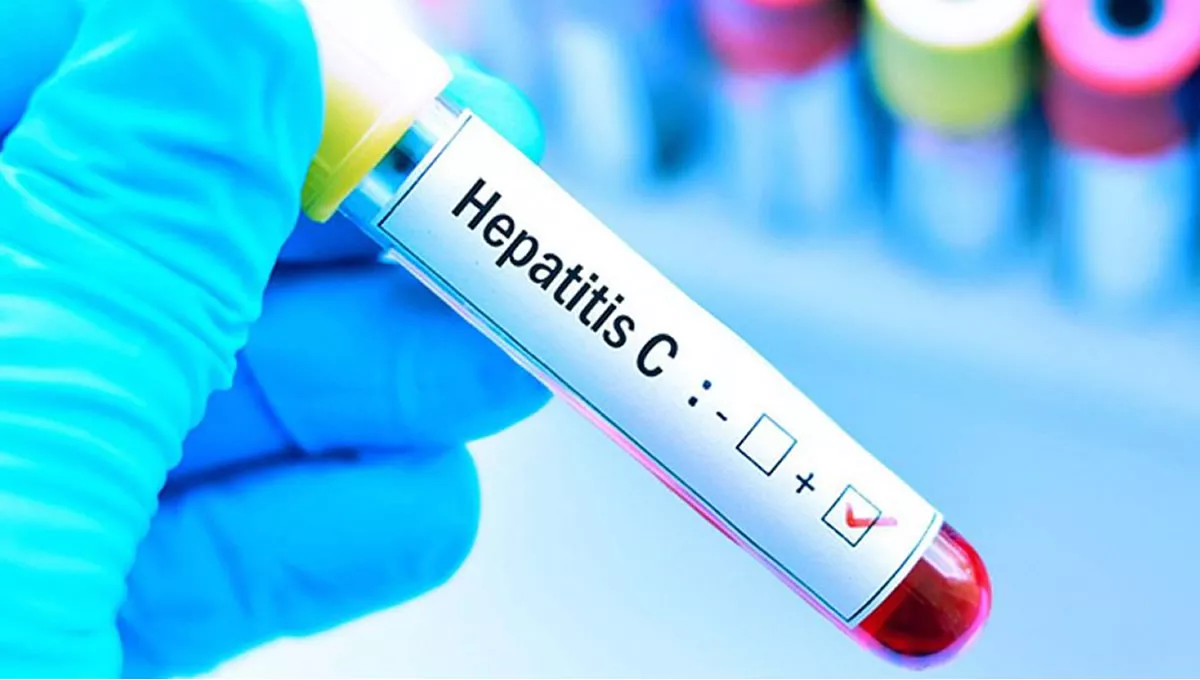 Hepatits C (foto: Freepik)