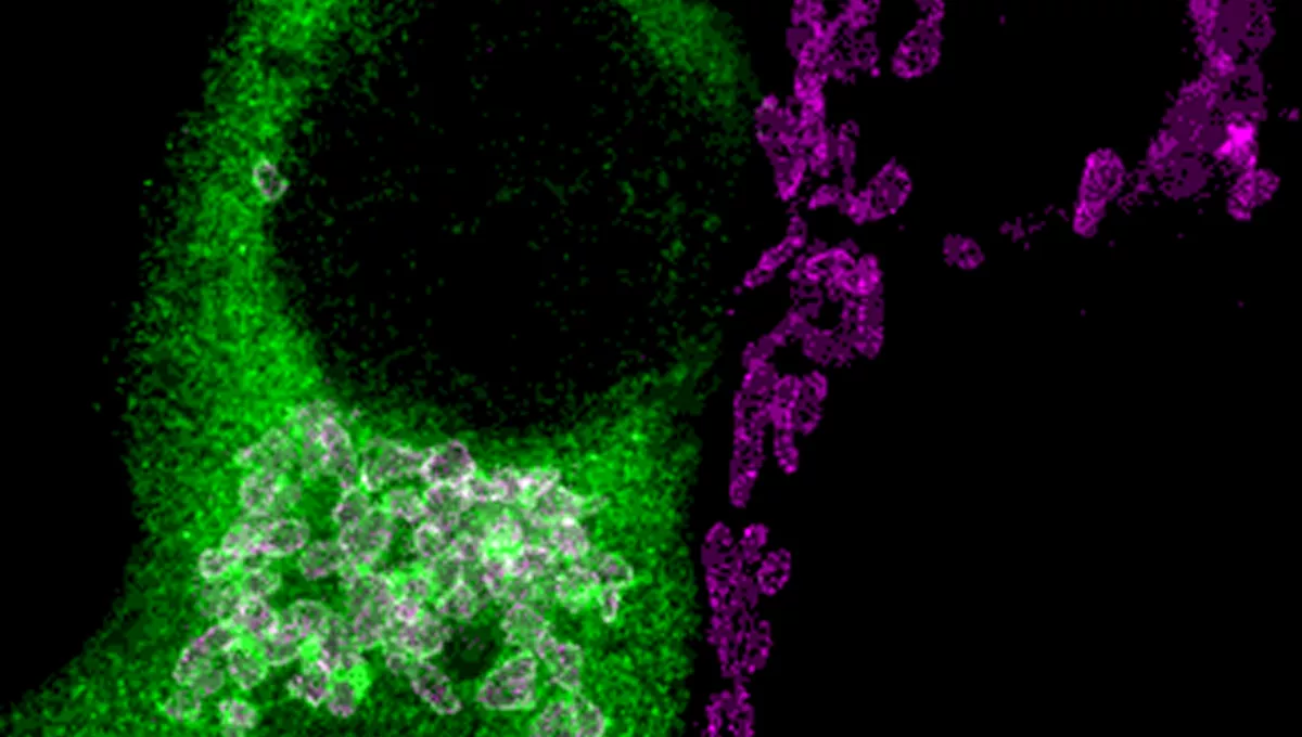 Demostración de que parte del transportador se encuentra en las mitocondrias mediante imagen de superresolución con microscopia STED con células HEZ293 transfectadas con el transportador de zinc (Foto: Rubén Vicente/UPF)