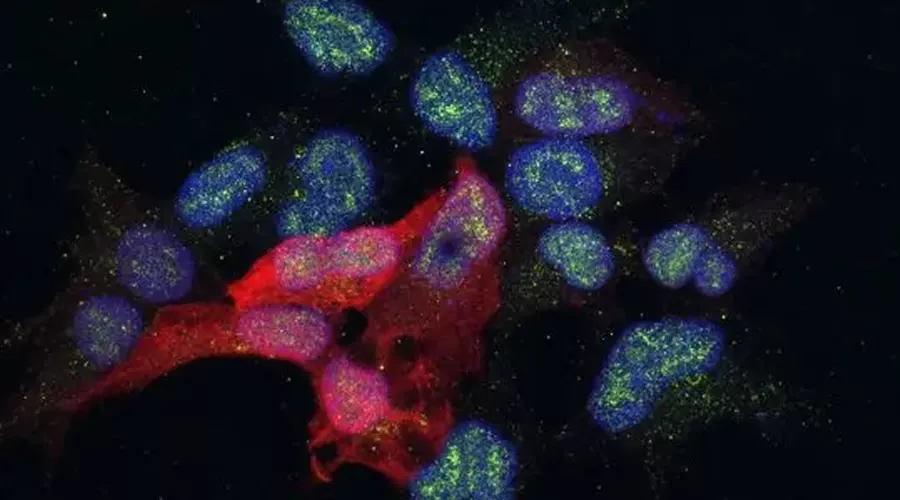 Células para estudiar una proteína (verde) implicada en la metástasis del cáncer de mama (Alicia Llorente, IRB Barcelona)