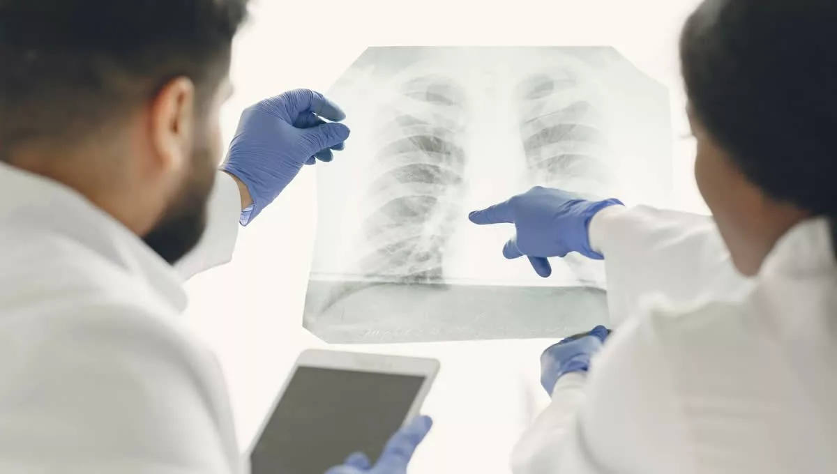 Doctores analizan una radiografía de pulmón (FOTO: Freepik)