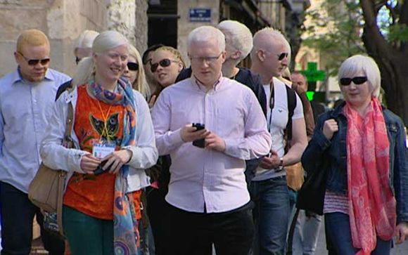 En España existen alrededor de 2.600 albinos
